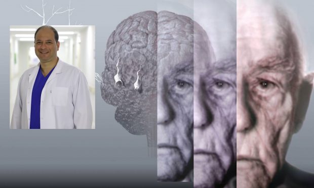 Alzheimer Hakkında Bilmedikleriniz!